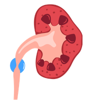 Outpatient kidney disease clinic